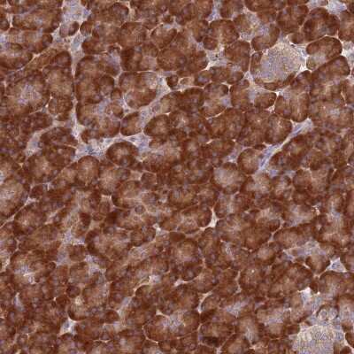 Immunohistochemistry: Ribosomal Protein L17 Antibody [NBP2-48845] - Staining of human pancreas shows strong cytoplasmic positivity in exocrine glandular cells.