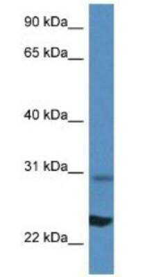 Western Blot: Ribosomal Protein L17 Antibody [NBP1-74075] - Mouse Liver Lysate 1ug/ml  Gel Concentration 12%