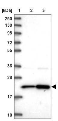 Western Blot: Ribosomal Protein L17 Antibody [NBP2-48798] - Lane 1: Marker [kDa] 250, 130, 95, 72, 55, 36, 28, 17, 10Lane 2: Human cell line RT-4Lane 3: Human cell line U-251MG sp