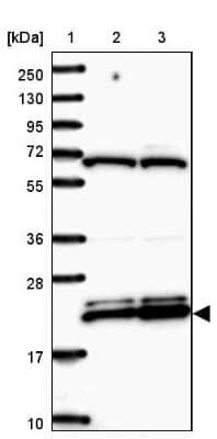 Western Blot: Ribosomal Protein L17 Antibody [NBP2-48845] - Lane 1: Marker [kDa] 250, 130, 95, 72, 55, 36, 28, 17, 10Lane 2: Human cell line RT-4Lane 3: Human cell line U-251MG sp