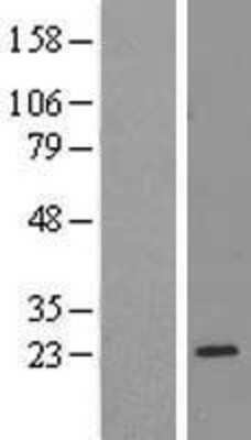 Western Blot: Ribosomal Protein L17 Overexpression Lysate (Adult Normal) [NBL1-15509] Left-Empty vector transfected control cell lysate (HEK293 cell lysate); Right -Over-expression Lysate for Ribosomal Protein L17.