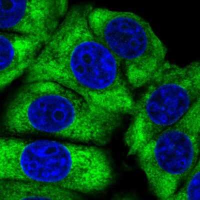 Immunocytochemistry/Immunofluorescence: Ribosomal Protein L24 Antibody [NBP2-33622] - Immunofluorescent staining of human cell line MCF7 shows localization to cytosol & endoplasmic reticulum.