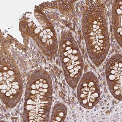 Immunohistochemistry: Ribosomal Protein L24 Antibody [NBP2-33622] - Staining of human colon shows strong cytoplasmic positivity in glandular cells.