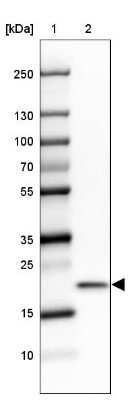 Western Blot: Ribosomal Protein L24 Antibody [NBP2-33622] - Lane 1: Marker [kDa] 250, 130, 100, 70, 55, 35, 25, 15, 10Lane 2: Human cell line SK-MEL-30