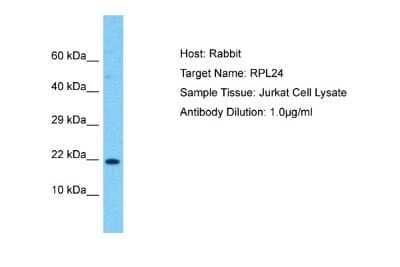 Western Blot: Ribosomal Protein L24 Antibody [NBP2-85636] - Host: Rabbit. Target Name: RPL24. Sample Type: Jurkat Whole Cell lysates. Antibody Dilution: 1.0ug/ml