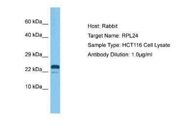 Western Blot: Ribosomal Protein L24 Antibody [NBP2-85636] - Host: Rabbit. Target Name: RPL24. Sample Tissue: Human HCT116 Whole Cell. Antibody Dilution: 1ug/ml