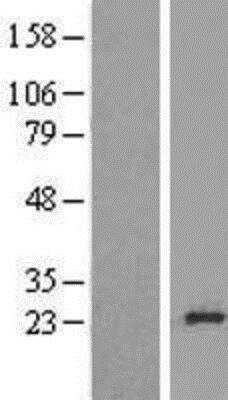 Western Blot: Ribosomal Protein L24 Overexpression Lysate [NBL1-15516] - Left-Empty vector transfected control cell lysate (HEK293 cell lysate); Right -Over-expression Lysate for RPL24/RLP24.