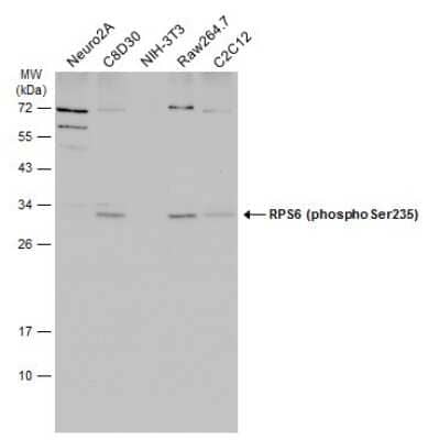 Western Blot: Ribosomal Protein S6/RPS6 [p Ser235] Antibody (GT829) [NBP3-13571] - Various whole cell extracts (30 ug) were separated by 12% SDS-PAGE, and the membrane was blotted with Ribosomal Protein S6/RPS6 (phospho Ser235) antibody [GT829] (NBP3-13571) diluted at 1:1000. The HRP-conjugated anti-mouse IgG antibody (NBP2-19382) was used to detect the primary antibody, and the signal was developed with Trident ECL plus-Enhanced.