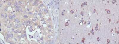 Immunohistochemistry: Ribosomal protein S27 Antibody (4A12) [NBP2-37672] - Immunohistochemical analysis of paraffin-embedded human lung cancer (left) and human brain (right) tissues using MPS1 mouse mAb with DAB staining.