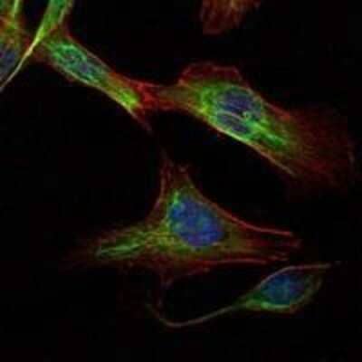 Immunocytochemistry/Immunofluorescence: Rictor Antibody (7B3) - Azide and BSA Free [NBP2-80925] - Analysis of NIH/3T3 cells using RICTOR mouse mAb (green). Blue: DRAQ5 fluorescent DNA dye. Red: Actin filaments have been labeled with Alexa Fluor-555 phalloidin. Image from the standard format of this antibody.