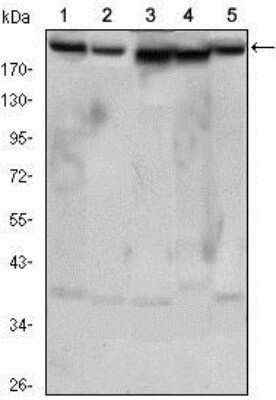 Western Blot: Rictor Antibody (7B3) - Azide and BSA Free [NBP2-80925] - Western blot analysis using RICTOR mouse mAb against Hela (1), PANC-1 (2), MOLT4 (3), HepG2 (4) and HEK293 (5) cell lysates. Image from the standard format of this antibody.