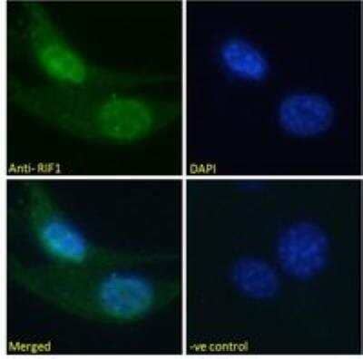 Immunocytochemistry/Immunofluorescence: Rif1 Antibody [NBP2-26129] - Analysis of paraformaldehyde fixed U2OS cells, permeabilized with 0.15% Triton. Primary incubation 1hr (10 ug/mL) followed by Alexa Fluor 488 secondary antibody (2 ug/mL), showing nuclear staining. The nuclear stain is DAPI (blue). Negative control: Unimmunized goat IgG (10 ug/mL) followed by Alexa Fluor 488 secondary antibody (2 ug/mL).