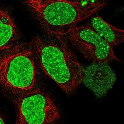 Immunocytochemistry/Immunofluorescence: Rif1 Antibody [NBP2-47303] - Staining  human cell line HEK 293 shows positivity in nucleus. Antibody staining is shown in green.