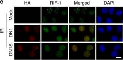 Immunocytochemistry/Immunofluorescence: Rif1 Antibody [NBP2-47303] - Identification of an HDR-enhancing fragment of 53BP1. Representative IF images showing HA-tagged DN1 or DN1S and RIF1 recruitment to IR-induced DNA repair foci. Image collected and cropped by CiteAb from the following publication (//www.nature.com/articles/s41467-019-10735-7), licensed under a CC-BY license.