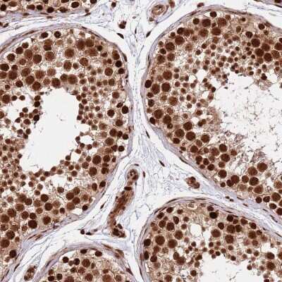 Immunohistochemistry: Rif1 Antibody [NBP2-47302] - Staining of human testis shows strong nuclear positivity.