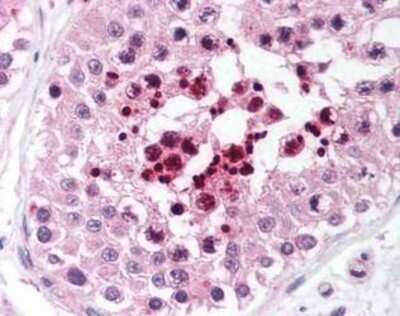 Immunohistochemistry-Paraffin: Rif1 Antibody [NB100-80875] - Staining of human testis. Immunohistochemistry of formalin-fixed, paraffin-embedded tissue after heat-induced antigen retrieval. Antibody concentration 5 ug/ml.