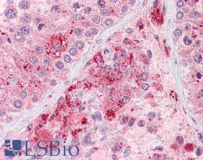 Immunohistochemistry-Paraffin: Rif1 Antibody [NB300-973] - Staining of paraffin embedded Human Testis. Steamed antigen retrieval with citrate buffer pH 6, AP-staining.