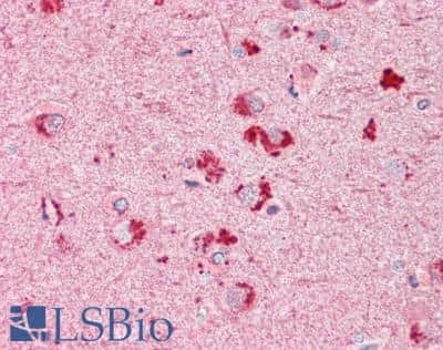 Immunohistochemistry-Paraffin: Rif1 Antibody [NB300-973] - Staining of paraffin embedded Human Cortex. Steamed antigen retrieval with citrate buffer pH 6, AP-staining.