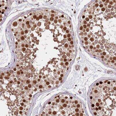 Immunohistochemistry-Paraffin: Rif1 Antibody [NBP2-47303] - Staining of human testis shows strong nuclear and cytoplasmic positivity in cells in seminiferus ducts.