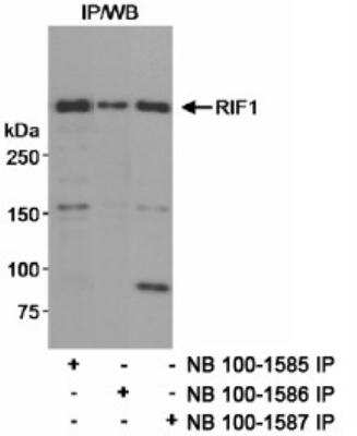 Immunoprecipitation: Rif1 Antibody [NB100-1585] - Detection of Human RIF1 on HeLa whole cell lysate using NB100-1585. RIF1 was also immunoprecipitated using rabbit anti-RIF1 antibodies NB100-1586 and NB100-1587.