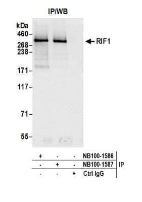 Rif1 Antibody [NB100-1586] - Detection of human RIF1 by western blot of immunoprecipitates. Samples: Whole cell lysate (0.5 or 1.0 mg per IP reaction; 20% of IP loaded) from HeLa cells prepared using NETN lysis buffer. Antibodies: Affinity purified rabbit anti-RIF1 antibody NB100-1586 used for IP at 6 ug per reaction. RIF1 was also immunoprecipitated by rabbit anti-RIF1 antibody NB100-1587. For blotting immunoprecipitated RIF1, NB100-1586 was used at 1 ug/ml. Detection: Chemiluminescence with an exposure time of 10 seconds.