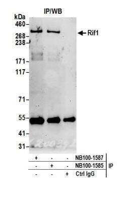 Rif1 Antibody [NB100-1587] - Detection of human Rif1 by western blot of immunoprecipitates. Samples: Whole cell lysate (0.5 or 1.0 mg per IP reaction; 20% of IP loaded) from HeLa cells prepared using NETN lysis buffer. Antibodies: Affinity purified rabbit anti-Rif1 antibody NB100-1587 used for IP at 6 ug per reaction. Rif1 was also immunoprecipitated by rabbit anti-Rif1 antibody NB100-1585. For blotting immunoprecipitated Rif1, NB100-1587 was used at 1 ug/ml. Detection: Chemiluminescence with an exposure time of 3 minutes.