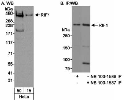 <b>Independent Antibodies Validation. </b>Immunoprecipitation: Rif1 Antibody [NB100-1586] - Whole cell lysate from HeLa cells. Whole cell lysate from 293T cells. Affinity purified rabbit anti-RIF1 antibody NB100-1586. RIF1 was also IPed using rabbit anti-RIF1 antibody NB100-1587.