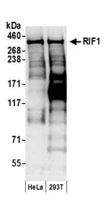 Western Blot: Rif1 Antibody [NB100-1586] - Detection of Human RIF1 by Western Blot. Samples: Whole cell lysate (50 ug) from HeLa and 293T cells prepared using NETN lysis buffer. Antibody: Affinity purified rabbit anti-RIF1 antibody NB100-1586 used for WB at 0.4 ug/ml. Detection: Chemiluminescence with an exposure time of 10 seconds.