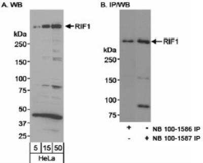 <b>Independent Antibodies Validation. </b>Western Blot: Rif1 Antibody [NB100-1587] - Whole cell lysate from 293T cells. RIF1 was also immunoprecipitated using rabbit anti-RIF1 antibody NB100-1586.