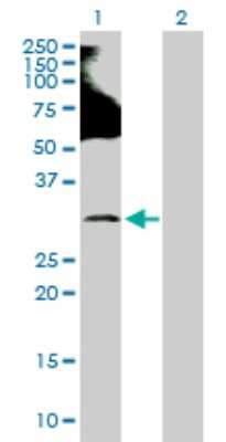Western Blot: Ring finger protein 138 Antibody [H00051444-D01P] - Analysis of RNF138 expression in transfected 293T cell line by RNF138 polyclonal antibody.Lane 1: RNF138 transfected lysate(28.20 KDa).Lane 2: Non-transfected lysate.