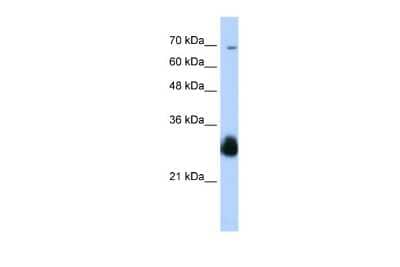 Western Blot: Ring finger protein 138 Antibody [NBP2-88154] - WB Suggested Anti-RNF138 Antibody Titration: 0.2-1 ug/ml. Positive Control: Transfected 293T