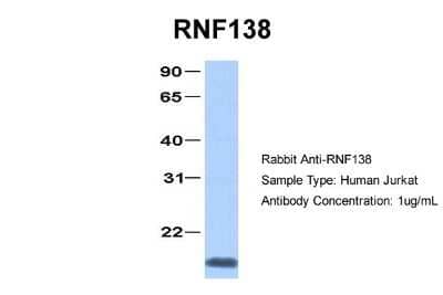 Western Blot: Ring finger protein 138 Antibody [NBP2-88154] - Host: Rabbit. Target Name: RNF138. Sample Type: Jurkat. Antibody Dilution: 1.0ug/mlRNF138 is supported by BioGPS gene expression data to be expressed in Jurkat