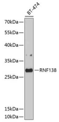 Western Blot: Ring finger protein 138 Antibody [NBP2-93425] - Analysis of extracts of BT-474 cells, using Ring finger protein 138 at 1:1000 dilution.Secondary antibody: HRP Goat Anti-Rabbit IgG (H+L) at 1:10000 dilution.Lysates/proteins: 25ug per lane.Blocking buffer: 3% nonfat dry milk in TBST.Detection: ECL Basic