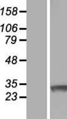 Western Blot: Ring finger protein 138 Overexpression Lysate (Adult Normal) [NBL1-15423] Left-Empty vector transfected control cell lysate (HEK293 cell lysate); Right -Over-expression Lysate for Ring finger protein 138.