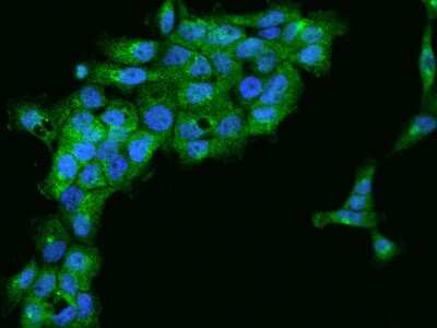 Immunocytochemistry/Immunofluorescence: Ring finger protein 214 Antibody [NBP2-97645] - Immunofluorescence staining of Ring finger protein 214 in A431 cells. Cells were fixed with 4% PFA, permeabilzed with 0.1% Triton X-100 in PBS, blocked with 10% serum, and incubated with rabbit anti-Human Ring finger protein 214 polyclonal antibody (dilution ratio 1:200) at 4C overnight. Then cells were stained with the Alexa Fluor(R)488-conjugated Goat Anti-rabbit IgG secondary antibody (green) and counterstained with DAPI (blue).Positive staining was localized to Cytoplasm.