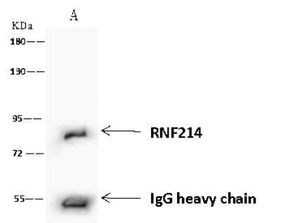 Immunoprecipitation: Ring finger protein 214 Antibody [NBP2-97645] - Ring finger protein 214 was immunoprecipitated using: Lane A: 0.5 mg Jurkat Whole Cell Lysate 4 ul anti-Ring finger protein 214 rabbit polyclonal antibody and 60 ug of Immunomagnetic beads Protein A/G.  Primary antibody: Anti-Ring finger protein 214 rabbit polyclonal antibody, at 1:100 dilution. Secondary antibody: Goat Anti-Rabbit IgG (H+L)/HRP at 1/10000 dilution. Developed using the ECL technique. Performed under reducing conditions. Predicted band size: 78 kDa. Observed band size: 78 kDa