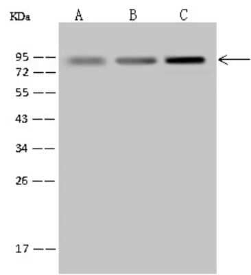 Western Blot: Ring finger protein 214 Antibody [NBP2-97645] - Anti-Ring finger protein 214 rabbit polyclonal antibody at 1:500 dilution. Lane A: HepG2 Whole Cell Lysate Lane B: 293T Whole Cell Lysate Lane C: Jurkat Whole Cell Lysate Lysates/proteins at 30 ug per lane. Secondary Goat Anti-Rabbit IgG (H+L)/HRP at 1/10000 dilution. Developed using the ECL technique. Performed under reducing conditions. Predicted band size: 78 kDa