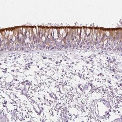 Immunohistochemistry-Paraffin: Ropporin 1-like Antibody [NBP1-90081] - Staining of human bronchus shows strong membranous positivity in respiratory epithelial cells.