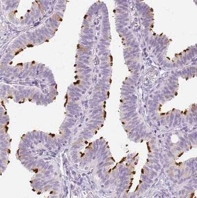 Immunohistochemistry-Paraffin: Ropporin 1-like Antibody [NBP1-90081] - Staining of human Fallopian tube shows strong positivity in cilia in glandular cells.