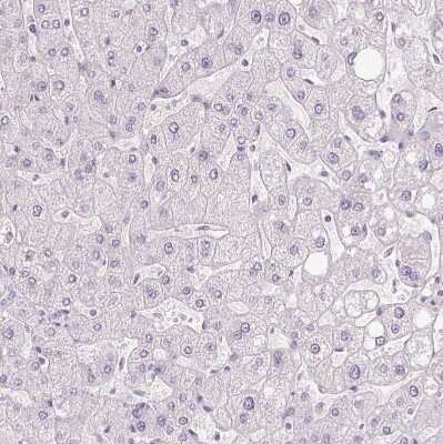 Immunohistochemistry-Paraffin: Ropporin 1-like Antibody [NBP1-90081] - Staining of human liver shows no positivity in hepatocytes as expected.