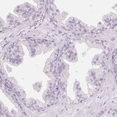 Immunohistochemistry-Paraffin: Ropporin 1-like Antibody [NBP1-90081] - Staining of human prostate shows no positivity in glandular cells as expected.