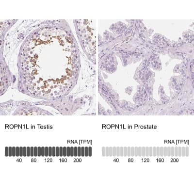 Immunohistochemistry-Paraffin Ropporin 1-like Antibody