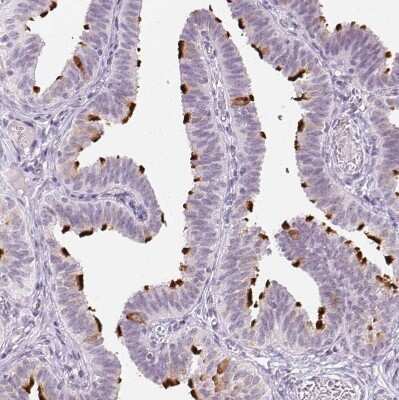 Immunohistochemistry-Paraffin: Ropporin 1-like Antibody [NBP2-47299] - Staining of human Fallopian tube shows strong positivity in cilia in glandular cells.