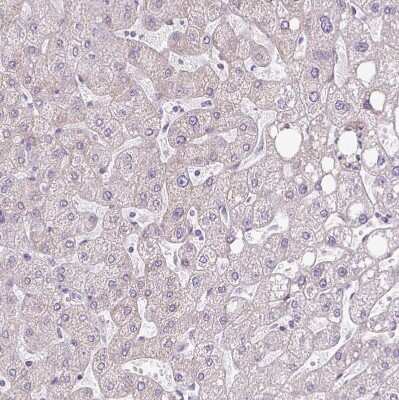 Immunohistochemistry-Paraffin: Ropporin 1-like Antibody [NBP2-47299] - Staining of human liver shows no positivity in hepatocytes as expected.