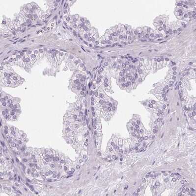 Immunohistochemistry-Paraffin: Ropporin 1-like Antibody [NBP2-47299] - Staining of human prostate shows no positivity in glandular cells as expected.