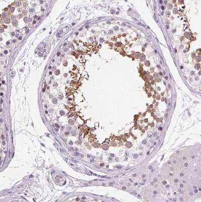 Immunohistochemistry-Paraffin: Ropporin 1-like Antibody [NBP2-47299] - Staining of human testis shows moderate cytoplasmic positivity in cells in seminiferous ducts.