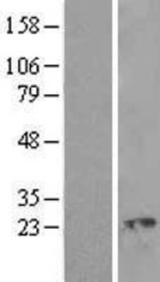 Western Blot Ropporin 1-like Overexpression Lysate