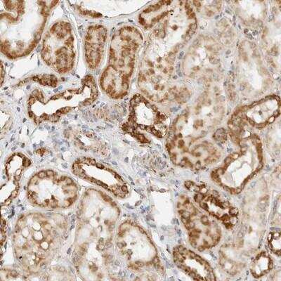 Immunohistochemistry: Roquin Antibody [NBP1-89590] - Staining of human kidney shows strong cytoplasmic positivity in renal tubules.