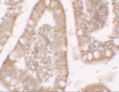Immunohistochemistry Roquin Antibody - BSA Free