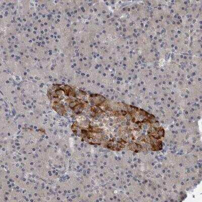 Immunohistochemistry-Paraffin: Roquin Antibody [NBP1-89591] - Staining of human pancreas shows strong cytoplasmic positivity in subsets of islet cells.